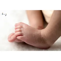 The tiny details are some of the most precious. I take close-up shots of those wrinkly little feet and peeling newborn skin, preserving the memory of just how small they were in their first few days.
