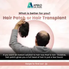 Hair patch or hair transplant? If you want an instant, non invasive solution, a hair patch can give you a full head of hair in hours. A transplant, however, is a permanent, natural solution that grows with you.
