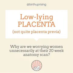 A diagnosis of "low-lying placenta" at 20 weeks can cause unnecessary worry. In over 98% of cases, the placenta "migrates" up and away from the cervix as the uterus grows, resolving the issue on its own before birth.