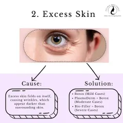 Problem: Excess Skin. Skin folds on itself, creating wrinkles that appear darker. We can treat this with Botox for mild cases, or a combination of PlasmoDerm and Botox for more moderate to severe cases.