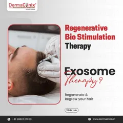 Another view of the Exosome therapy procedure, a non-surgical way to regenerate and regrow your hair.