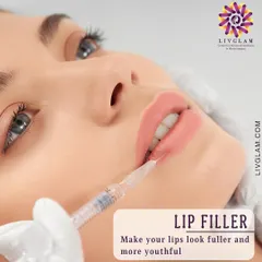 Lip fillers are a popular choice for adding volume and definition. This image shows the precision involved in the procedure, which I use to enhance the natural shape of the lips for a fuller, more balanced look.
