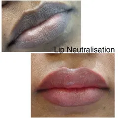 A clear example of how lip neutralization works. I corrected the cool, dark tones in the 'before' to achieve the warm, rosy, and even color you see in the 'after'.