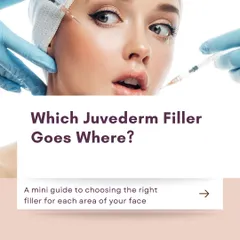 Not all fillers are the same. This guide explains which Juvederm filler is best suited for different areas of the face, from lips and cheeks to the under-eye area.