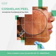 Struggling with melasma or photodamage? The Cosmelan peel is the leading worldwide depigmentation method, backed by a proven homecare plan to treat even the most stubborn skin spots with maximum efficiency and safety.