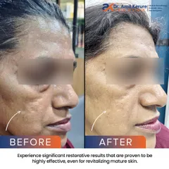 This angle highlights the restorative results on mature skin, proving that advanced treatments can be highly effective at any age.