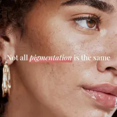 Understanding the root cause of your pigmentation is the first step. Whether it's hormonal melasma, sun spots, or post-acne marks, I create a tailored treatment plan because a generic approach doesn't deliver real results.