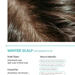 A "winter scalp" presents differently from dandruff. The flakes are usually tiny, white, and powdery, and the scalp feels tight and stretched. This is caused by dehydration and low humidity, not an infection, and needs a treatment focused on hydration.