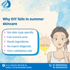 An infographic explaining why DIY skincare often fails, especially in the summer. Home remedies are not skin type specific and can lead to irritation, burns, and worsened acne.