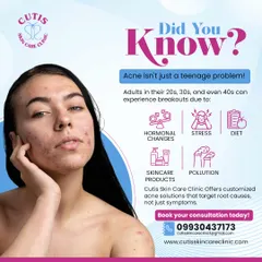 Did you know acne isn't just a teenage problem? We treat adult acne caused by hormones, stress, and other factors by creating customized solutions that target the root cause, not just the surface symptoms.