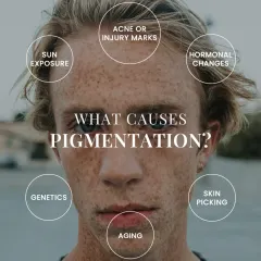 This visual chart outlines the primary causes of pigmentation, from genetics and sun exposure to hormonal changes and skin picking. Identifying the cause is key to effective treatment and prevention.