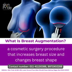 What is breast augmentation? This educational graphic explains that it is a cosmetic surgery procedure designed to increase breast size and change breast shape, helping you achieve your desired body contour.