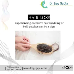 Experiencing excessive shedding on your hairbrush or in the shower is another major indicator. While some daily hair fall is normal, finding clumps of hair or noticeable bald patches is a sign that you need a professional consultation.