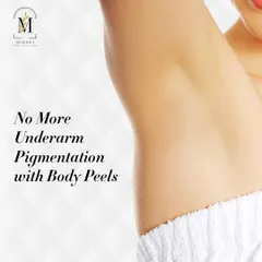 Say no more to underarm pigmentation with my specialized body peels, perfect for those who feel shy about wearing sleeveless clothes.