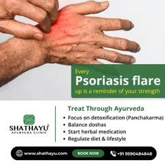 We understand the challenges of Psoriasis and offer a supportive path to healing. Our Ayurvedic treatment focuses on detoxification with Panchakarma, balancing doshas, and regulating diet and lifestyle for long-term management.