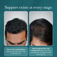 **Support Exists at Every Stage:** Whether you need non-surgical treatments to slow early thinning or Direct Hair Implantation to restore lost density, we have a solution. This image shows that our expert-led treatments are designed for your specific stage and goals.