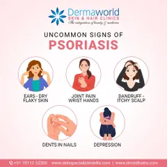 Psoriasis can show up in uncommon ways, such as joint pain, dents in nails, or a very itchy scalp that looks like dandruff. Recognizing these less obvious signs is important for getting a timely and accurate diagnosis.
