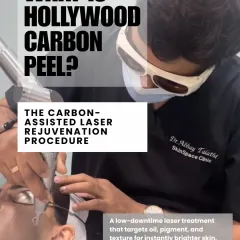 Here you can see me, Dr. Abhay Talathi, performing a Hollywood Carbon Peel. We believe in showing you the science behind the glow. This is a low-downtime laser treatment that we use to target oil, pigment, and texture, delivering instantly brighter skin for both brides and grooms.