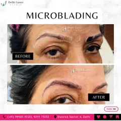 Microblading is effective for all ages. Here, we restored definition and shape to mature eyebrows that had become thin over time, giving the face a more youthful and lifted appearance. The strokes are designed to blend seamlessly with existing hair.