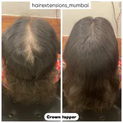This before and after shows the effectiveness of our custom crown topper. It is designed to conceal hair thinning at the crown, blending perfectly with the client's natural hair for a fuller, more confident appearance.
