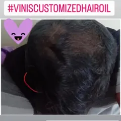 Look at the amazing 'after' result. This is what consistency with a good, natural hair care routine can do. It makes me so happy to see such progress.