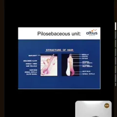Understanding the science of hair is the first step to effective treatment. This slide from one of my educational webinars illustrates the pilosebaceous unit, the complex structure responsible for hair growth, which is central to our hair restoration therapies.