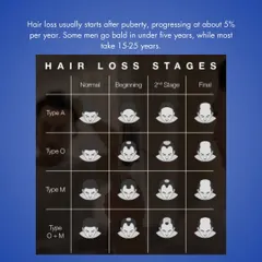Hair loss in men often follows predictable stages, as shown in this chart. Understanding where you are in the process helps us determine the most effective treatment, whether it's medical management for early stages or a transplant for more advanced loss.