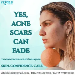 The message here is one of hope: acne scars are not permanent. With the right treatments, such as microneedling or laser resurfacing, we can significantly fade these marks and restore a smoother skin surface.