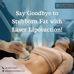 This image shows a Laser Liposuction treatment in progress on the abdominal area. I use focused laser energy to gently liquefy fat cells, allowing for precise body sculpting and contouring. This minimally invasive technique is excellent for achieving a more defined and toned physique.