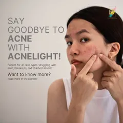 AcneLight is an FDA-approved light therapy that is perfect for treating active breakouts. It effectively targets acne-causing bacteria, reduces inflammation, and controls oil production, making it a safe and painless option even for sensitive, acne-prone skin.