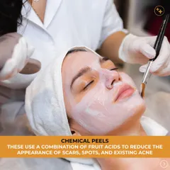 Chemical peels are a highly effective treatment for improving skin texture and reducing acne. We use a customized combination of fruit acids to exfoliate the skin, which helps to reduce the appearance of scars, spots, and existing acne for a clearer complexion.