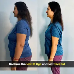 A side-profile view of Rashmi's 21kg transformation, showing a significant reduction in body fat and improved posture.