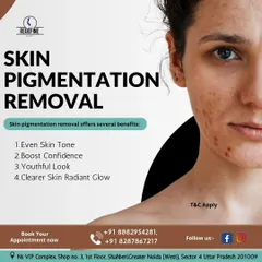 Uneven skin tone and pigmentation can affect confidence. This graphic highlights the key benefits of seeking professional treatment, which include achieving a clearer, more youthful look and a radiant glow.