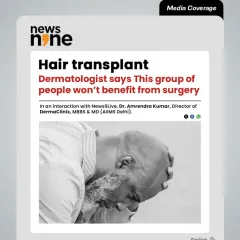 A hair transplant is not for everyone. This media coverage from News9Live discusses which groups of people may not benefit from surgery. We believe in honest consultations and will tell you if you are not an ideal candidate.