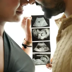 A close-up shot focusing on the sonogram pictures, held by the couple in a tender embrace. The first glimpse of your little one.