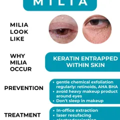 This infographic explains what Milia are (keratin trapped in the skin) and provides professional advice on prevention and treatment.