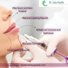 This visual explains the key benefits of lip fillers. Beyond just volume, they provide definition, improve symmetry, and boost confidence with long-lasting, natural-looking results.