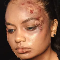A demonstration of our DIY SFX makeup skills, creating realistic looking wounds, bruises, and scars. This is an advanced technique taught in our courses for aspiring film and theatrical makeup artists.