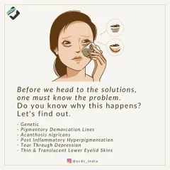 To find the right solution for dark circles, we first diagnose the cause. It could be genetic, pigmentary, or related to the thin skin under the eyes.