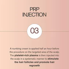 The final step is the PRP injection. After applying a topical numbing cream to ensure your comfort, I carefully inject the concentrated platelet-rich plasma into the areas of the scalp requiring treatment, stimulating the hair follicles directly.