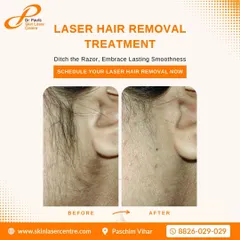 This is a typical result from my laser hair reduction treatment. It provides a long term solution for unwanted hair, leaving the skin smooth and clear compared to temporary methods like shaving.