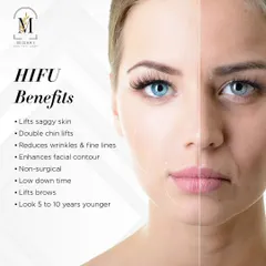A comprehensive list of HIFU benefits, from lifting saggy skin and reducing wrinkles to enhancing facial contour for a look that is 5 to 10 years younger.