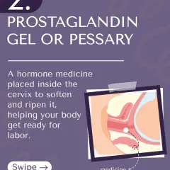 Method 2: Prostaglandin gel or pessary. This is a hormone medicine placed near the cervix to help it soften and ripen.