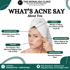 The location of your acne can tell you a lot about its cause. This face map links breakouts on the forehead, cheeks, and jawline to potential triggers like hormones, diet, or leftover makeup.