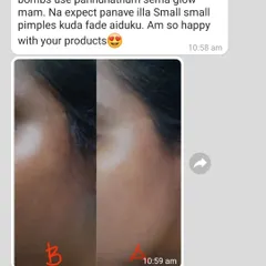It makes me so happy to see the real difference my products make. This customer saw a visible reduction in small pimples and a wonderful glow after using the gold facial bombs. This is why I believe in natural, gentle care.