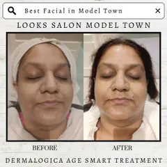Real, visible results are what we promise. This before and after showcases the power of a single Dermalogica Age Smart Treatment, revealing brighter, smoother, and more youthful-looking skin.