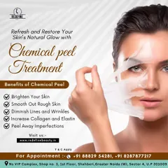 This graphic details the benefits of our Chemical Peel Treatment. It helps brighten your skin, smooth out rough texture, diminish lines, and increase collagen for a refreshed appearance.