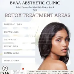 An informational graphic detailing the common treatment areas for Botox. We address concerns such as forehead lines, frown lines, crow's feet, and even a gummy smile for a balanced, natural result.