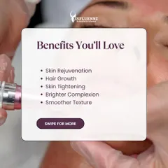 The benefits of Exosome therapy are extensive. For hair, it is a powerful tool for stimulating new growth. It also offers skin rejuvenation, tightening, and a brighter complexion.