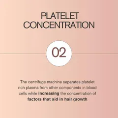 Next is platelet concentration. The centrifuge machine spins the blood sample at high speed, separating the plasma and concentrating the platelets. This process significantly increases the concentration of growth factors that are vital for hair follicle stimulation.